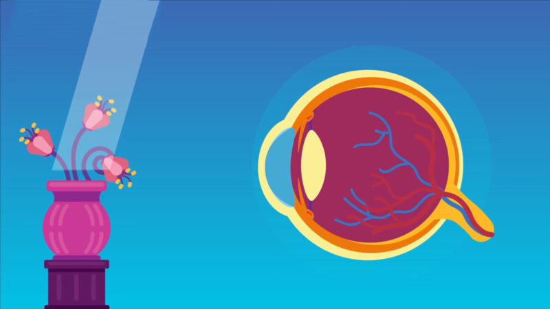 Hyperopia (Far-sightedness) Visual