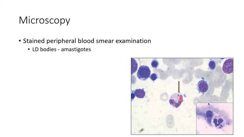 Microscopy Kala Azar