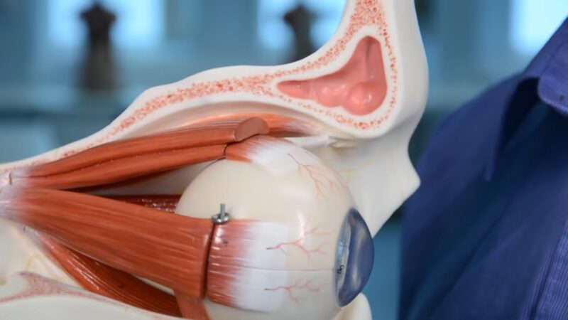 Muscles of the eye