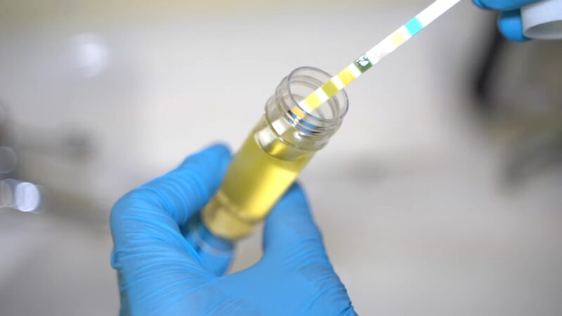 Performing a Urinalysis Test