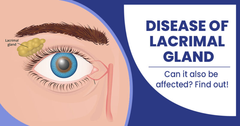 dacryoadenitis